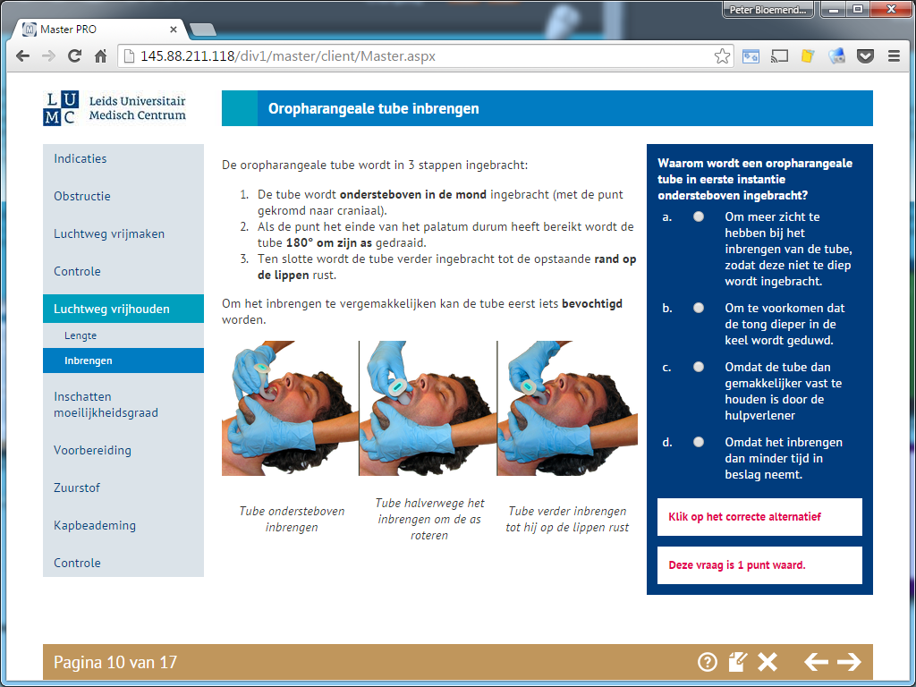 Basic Airway management