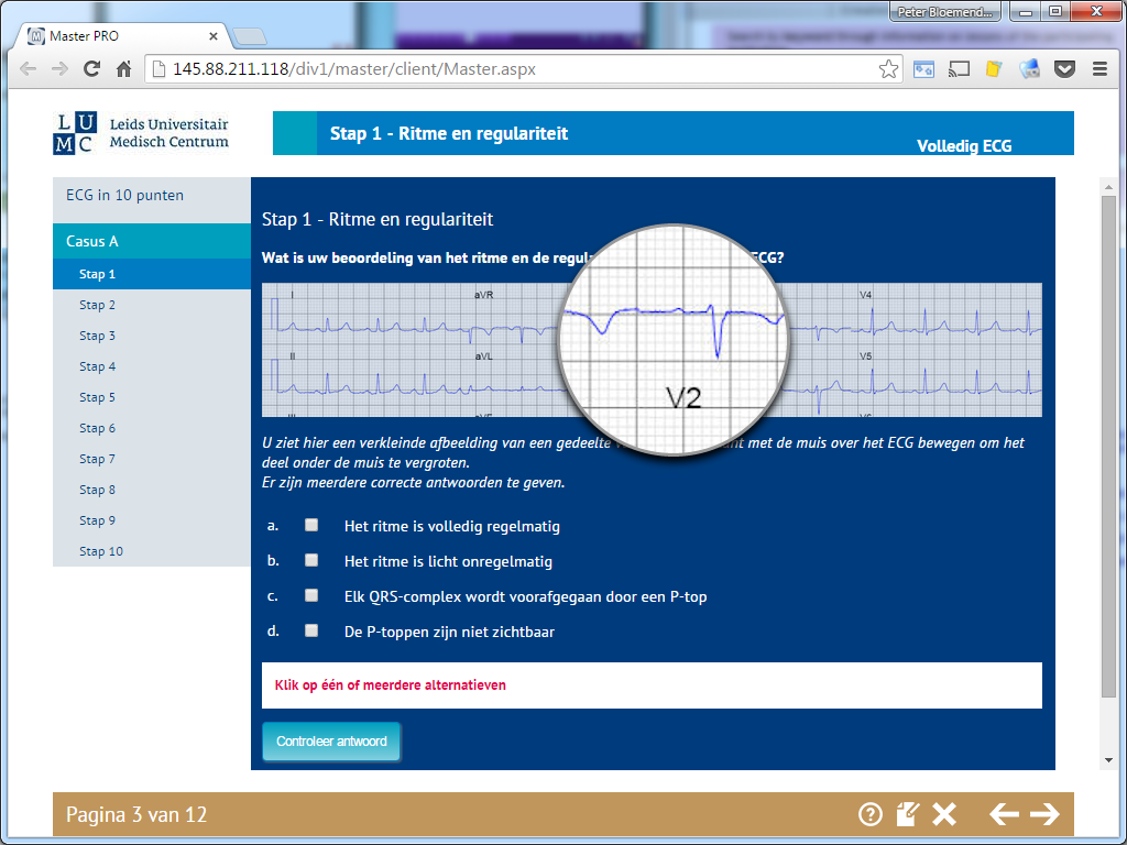 Echoscopie Foetale Biometrie